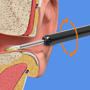 Cuillère d'élimination de cire visible Wi-Fi, otoscope de charge USB HD