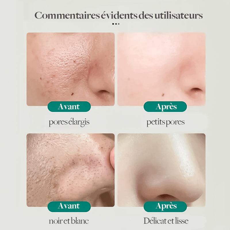 Xiehe Sud Niacinamide Nettoyant Facial Blanchissant